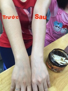 Tẩy da chết quế hồi nga