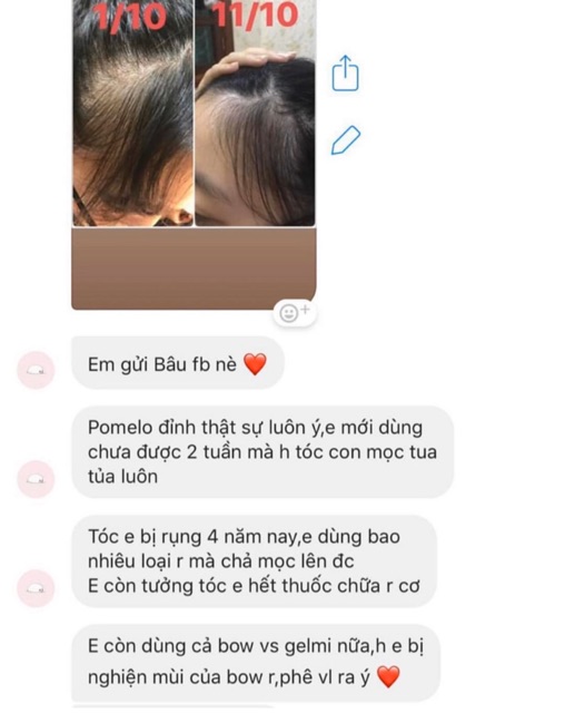 Pro POMELO Hair Mist - Xịt Bưởi Kích Mọc Tóc X2 ( Mẫu mới 2021 ) | BigBuy360 - bigbuy360.vn