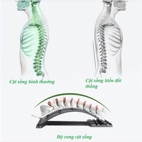 [Mã FAMAYMA giảm 10K đơn 50K] Dụng cụ hỗ trợ tập lưng giúp giảm đau lưng, giảm thoái hóa đốt sống