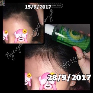 Xịt bưởi thảo mộc thần thánh Thái Lan 100ml