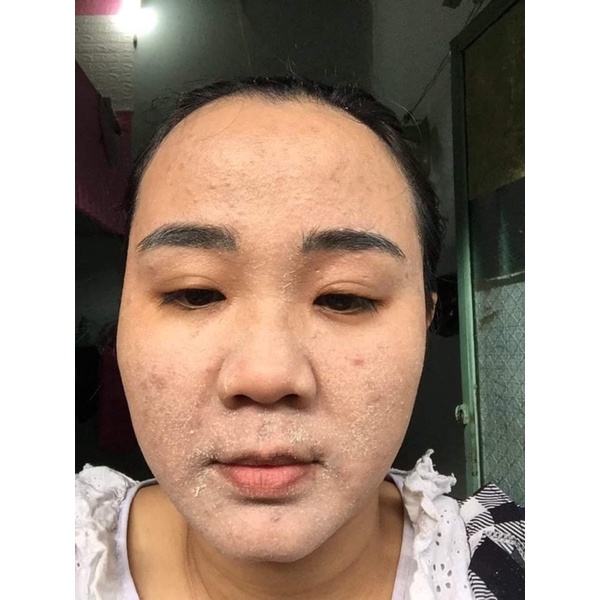 Kem Tái Tạo Da   My My T&M 20 gam tặng kích bong