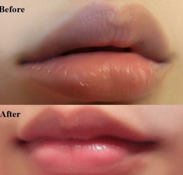 Tẩy Da Chết ❤️FREESHIP❤️ Tẩy Da Chết Môi Beauty Treats Lip Scrub