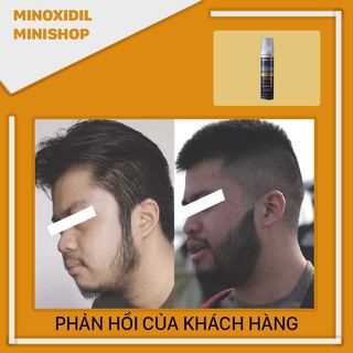 Minoxidil 5% Dạng Bọt Mọc Râu Tóc Kirkland Mỹ