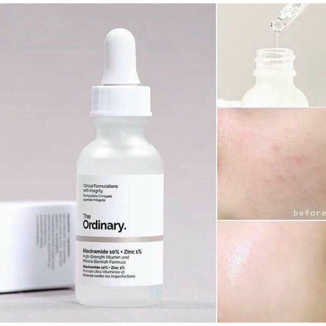 Serum  ngừa mụn, sáng da,se khít Niacinamide 10% + Zinc 1% - The Ordinary