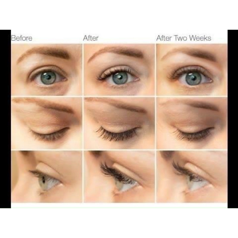 Dưỡng Mi Careprost Bimatoprost Ophthalmic Solution