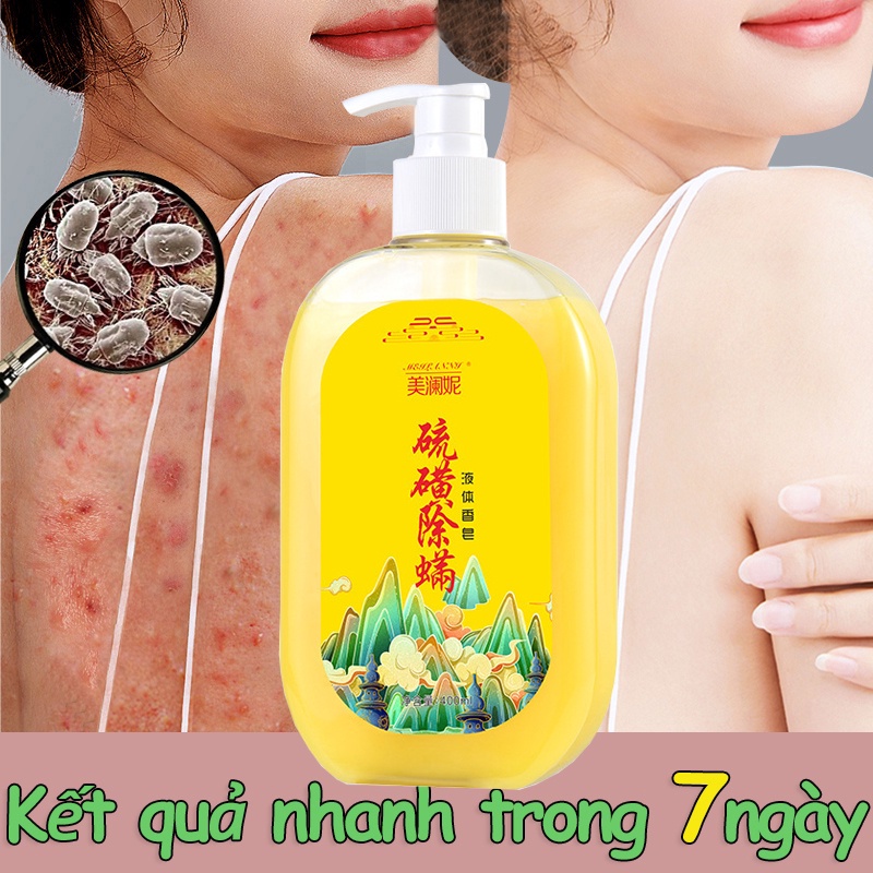 sữa tắm chống mụn 260ml sữa tắm dưỡng trắng giúp giải quyết vấn đề da khô ráp ngứa kháng khuẩn loại loại bỏ mùi mùi hôi