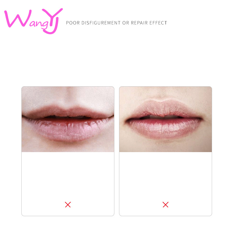 [Hàng mới về] Mặt Nạ Môi Dưỡng Ẩm Chống Khô Môi 13g | BigBuy360 - bigbuy360.vn