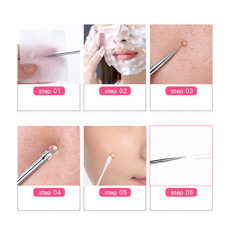 [Hàng mới về] Cây kim diệt mụn đầu đen tiện dụng