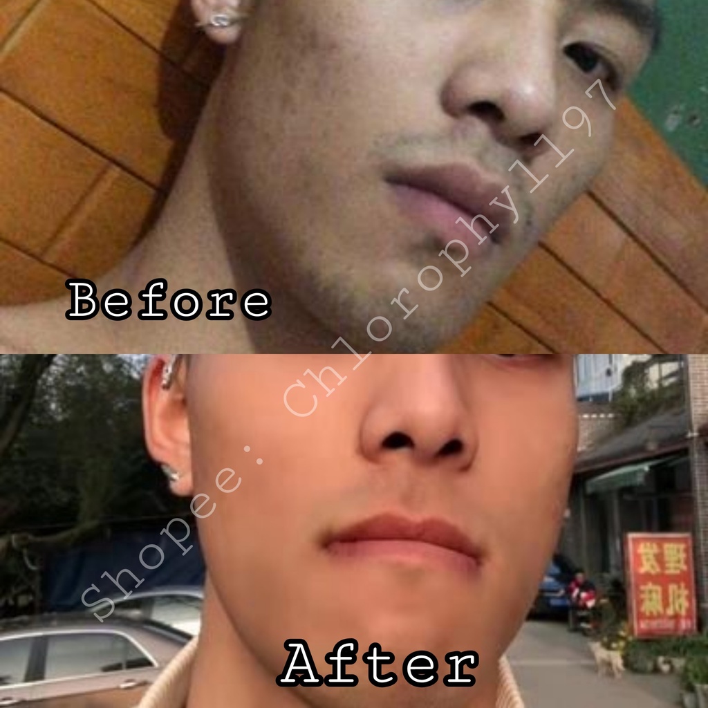 Kem giảm mụn, dưỡng sáng, mờ thâm, tẩy tế bào chết dịu nhẹ Azelaic Acid 15% Gel 10gr Gorgeous Beauty