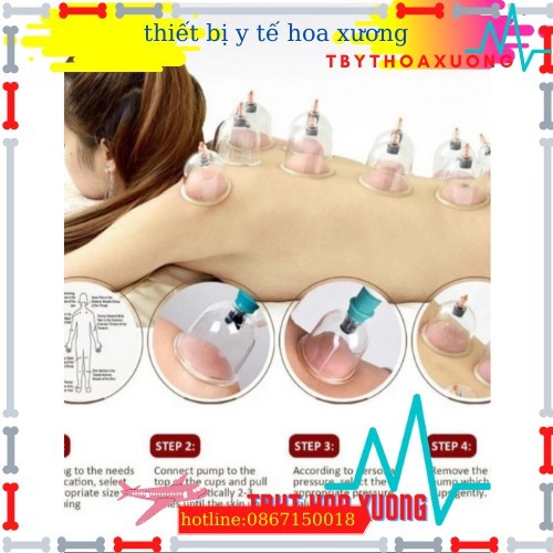 BỘ GIÁC HƠI KHÔNG DÙNG LỬA 12 ỐNG GIÁ RẺ NHẤT THỊ TRƯỜNG