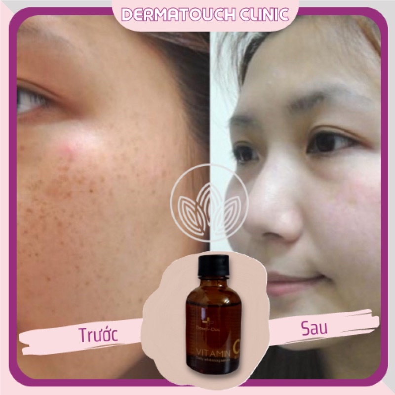 Serum Vitamin C Goodndoc dưỡng trắng da (30mL) - Dược mỹ phẩm Derma Touch