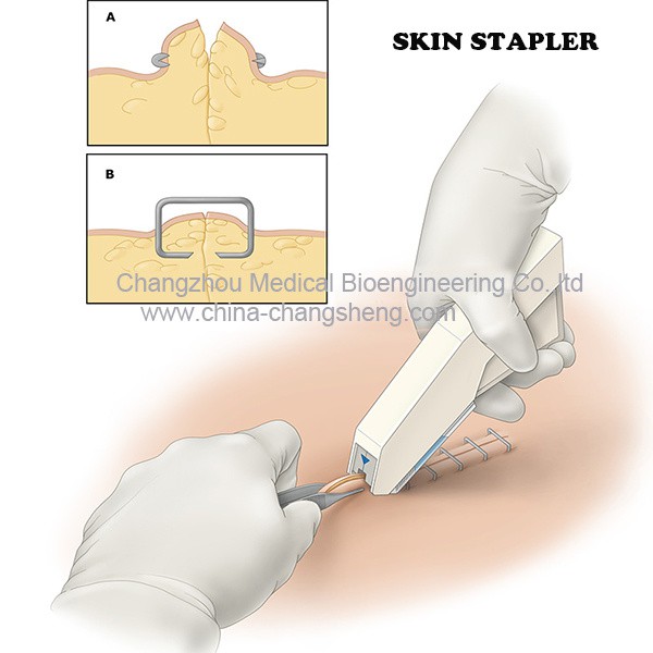 DỤNG CỤ BẤM DA SLIM BODY SKIN STAPLER