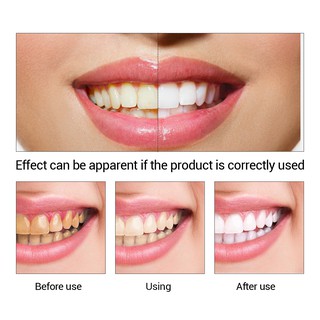 Tinh chất Lanbena giúp làm trắng răng 10ml