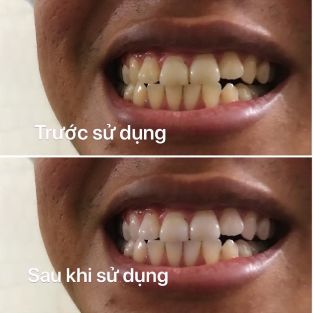 Than hoat tính