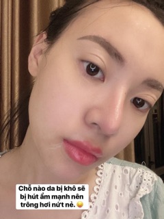 Set lẻ GEL NÂNG CƠ THẢI ĐỘC CARE CELLA