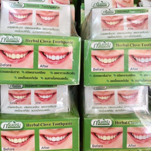 Kem Trắng Răng Green Herb Thái Lan 25g (tặng kèm hộp nhỏ)