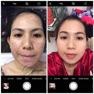DIỆP LỤC COLLAGEN (10 GÓI )