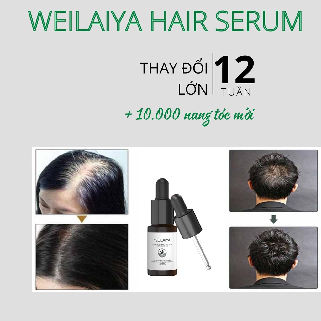 Huyết thanh Weilaiya , ngăn ngừa rụng tóc , hỗ trợ mọc tóc , giúp tóc chắc khỏe  5ml [ CHÍNH - HÃNG ]