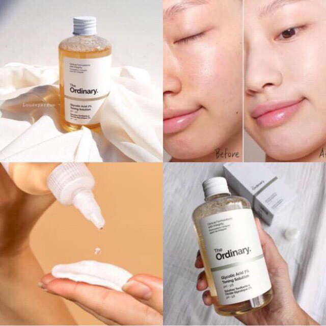 Toner tẩy da chết The Ordinary Glycolic Acid 7% Toning Solution 240ml.