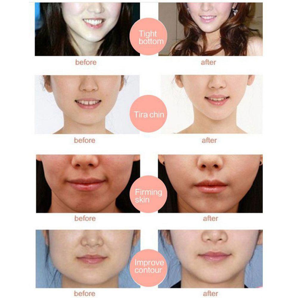 Mặt Nạ NORMAN 4D Làm Thon Gọn Và Săn Chắc Da