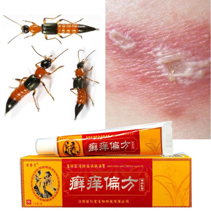 Kem bôi đặc tri kiến ba khoang