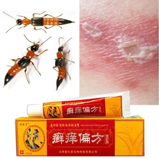 Kem bôi đặc tri kiến ba khoang - Côn trùng cắn, dị ứng da