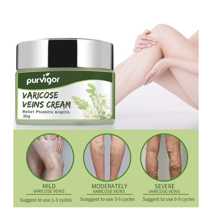 Kem hỗ trợ giãn tĩnh mạch chân Purvigor Varicose Veins Relief Cream 50g USA