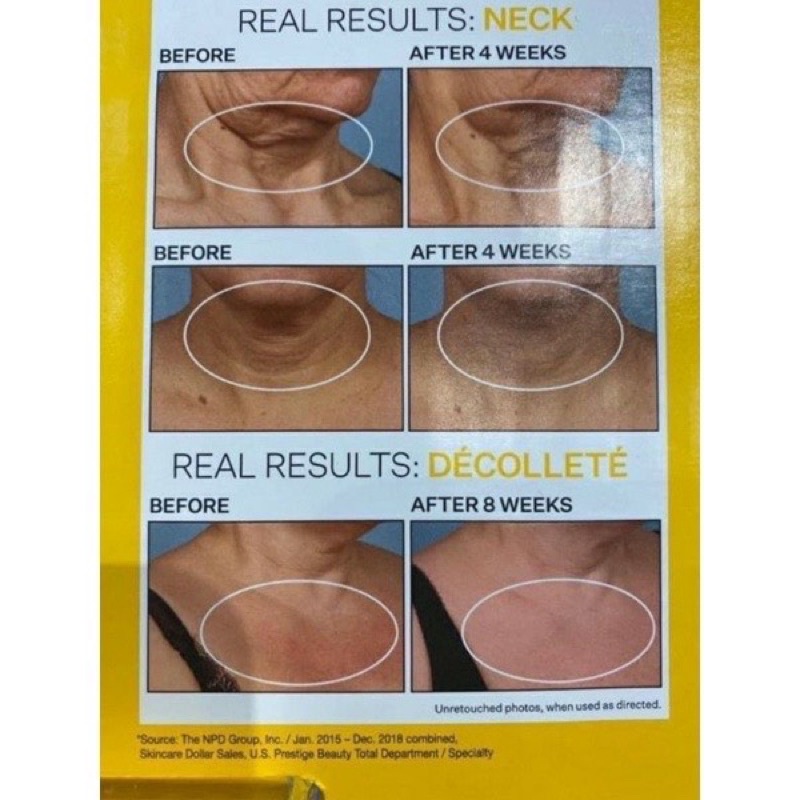 [HÀNG MỸ] Kem dưỡng da cổ Strivectin Mỹ