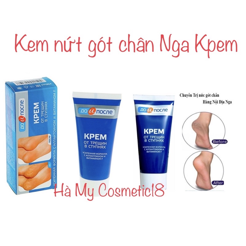 Kem nứt gót chân Nga Kpem