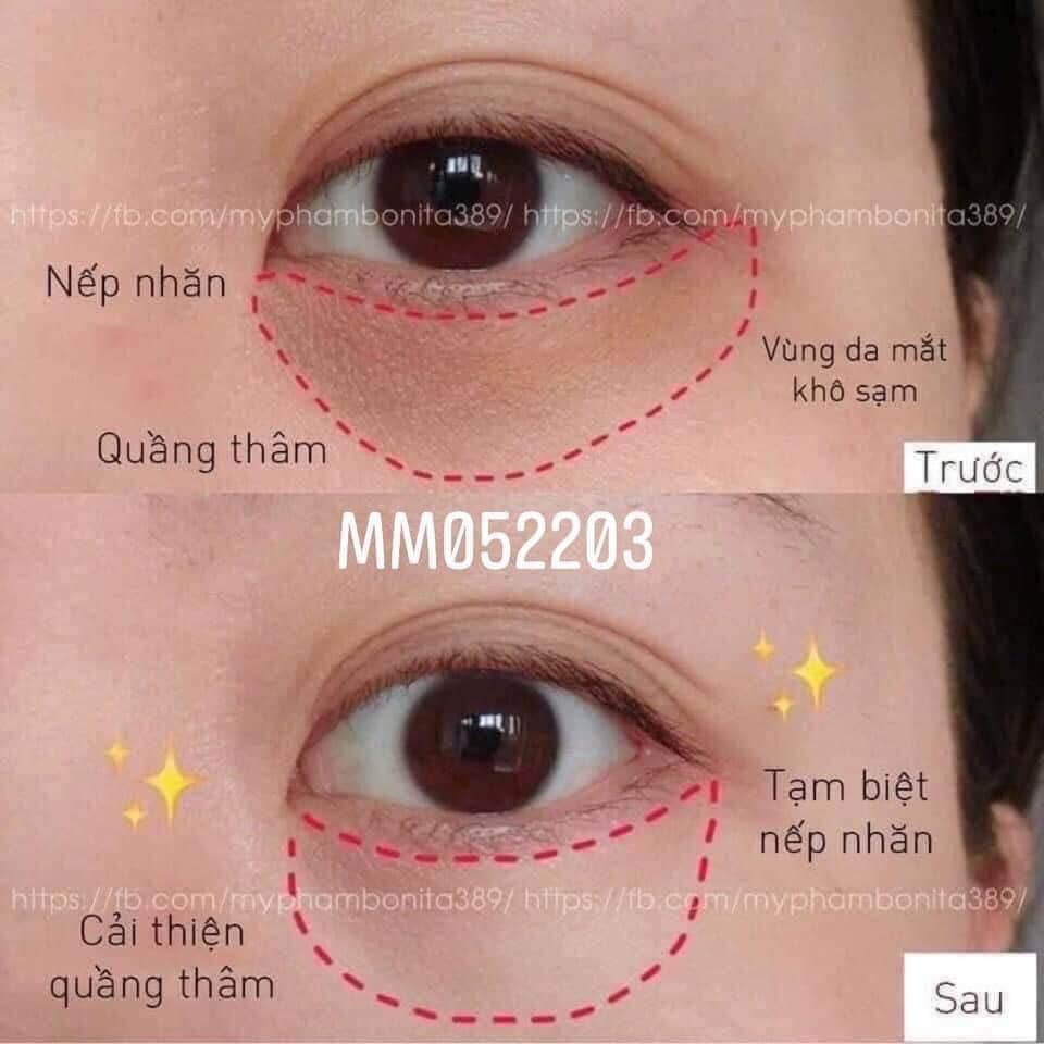 1 hộp 60 miếng - MẶT NẠ MẮT BIOAQUA hộp 60 miếng | BigBuy360 - bigbuy360.vn