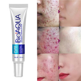 [Hàng mới về] Kem Bioaqua dạng gel 30g loại bỏ mụn đầu đen/ trứng cá/ kiểm soát dầu/ thu nhỏ lỗ chân lông/ mờ sẹo mụn