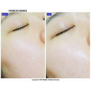 Serum Ciracle Wrinkle Hydra B5 Source cấp ẩm phục hồi da 30ml
