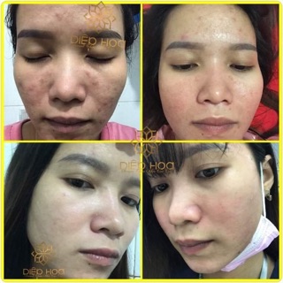 Serum Thảo Mộc OGANA