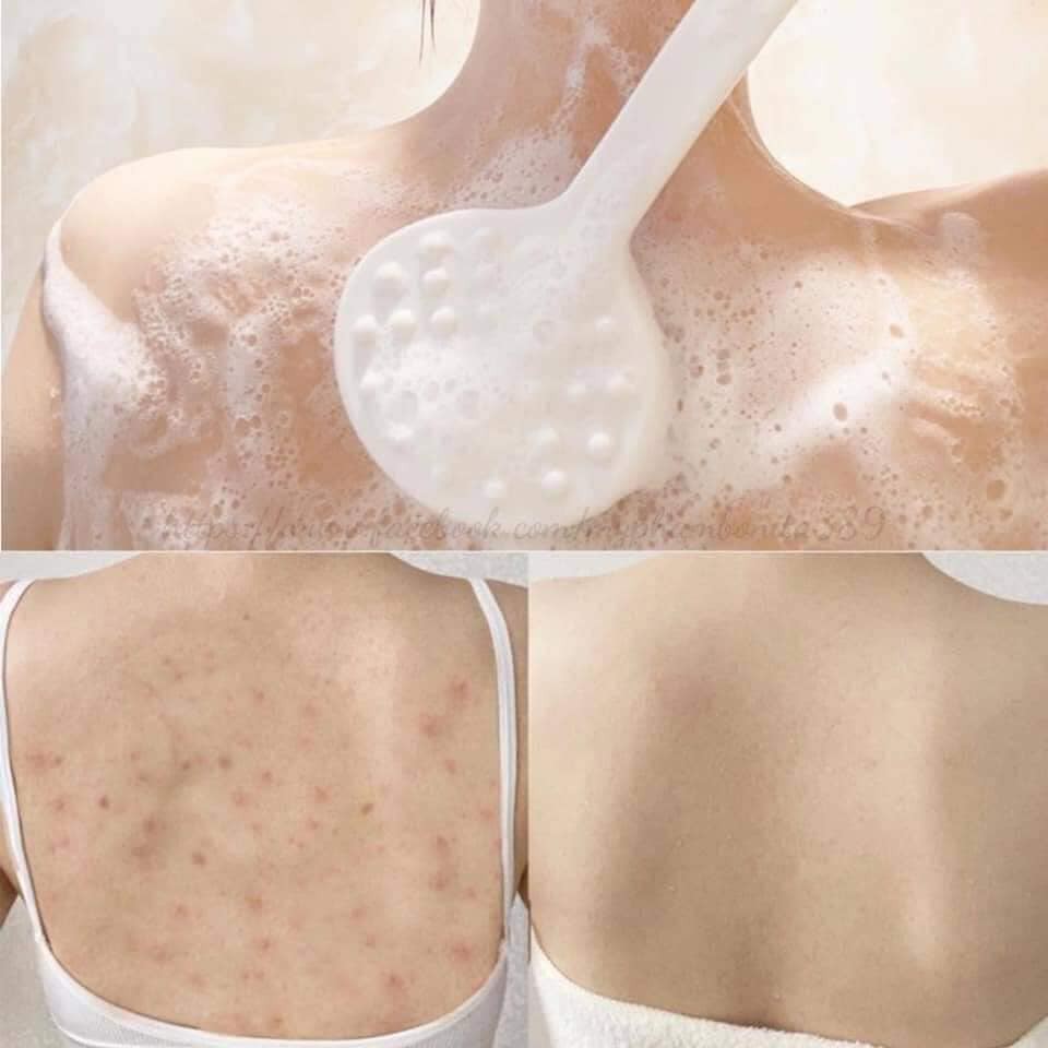 Sữa Tắm Giảm Mụn Body Some By Mi AHA-BHA-PHA 30 Days Miracle Ance Clear Body Cleanser 400g _Some By MI Chính Hãng