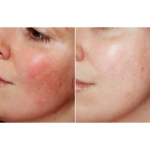 Bộ Dưỡng phục hồi da Some By Me SNAIL TRUECICA MIRACLE REPAIR | BigBuy360 - bigbuy360.vn