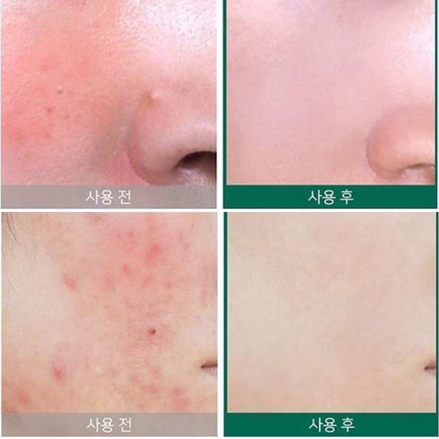 SOME BY MI AHA - BHA - PHA 30 DAYS MIRACLE CREAM