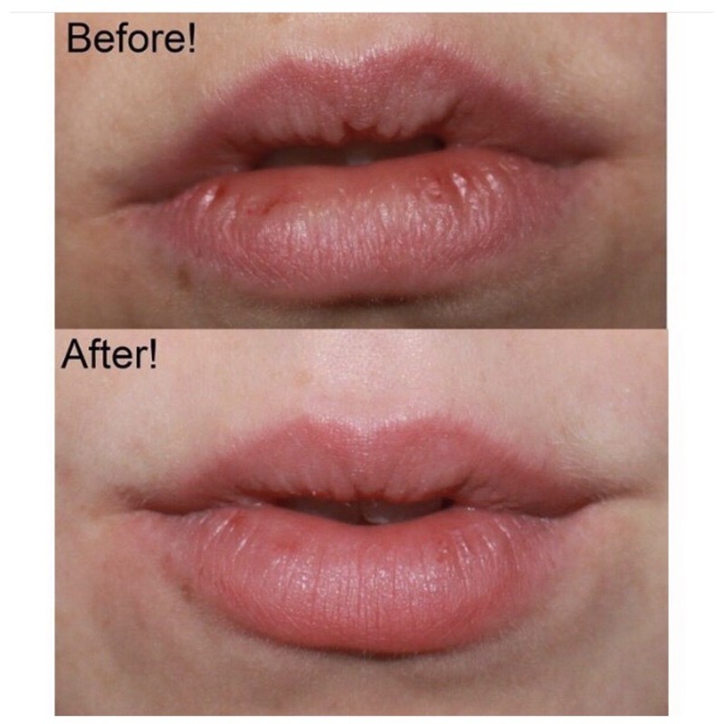 Tẩy tế bào chết môi | BigBuy360 - bigbuy360.vn