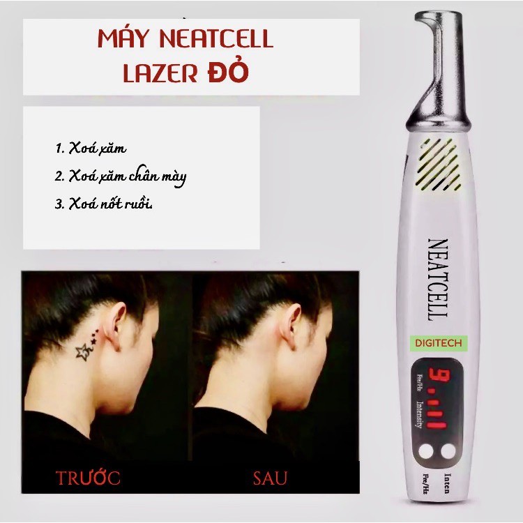 Máy xoá xăm chân mày NEATCELL- Lazer Đỏ