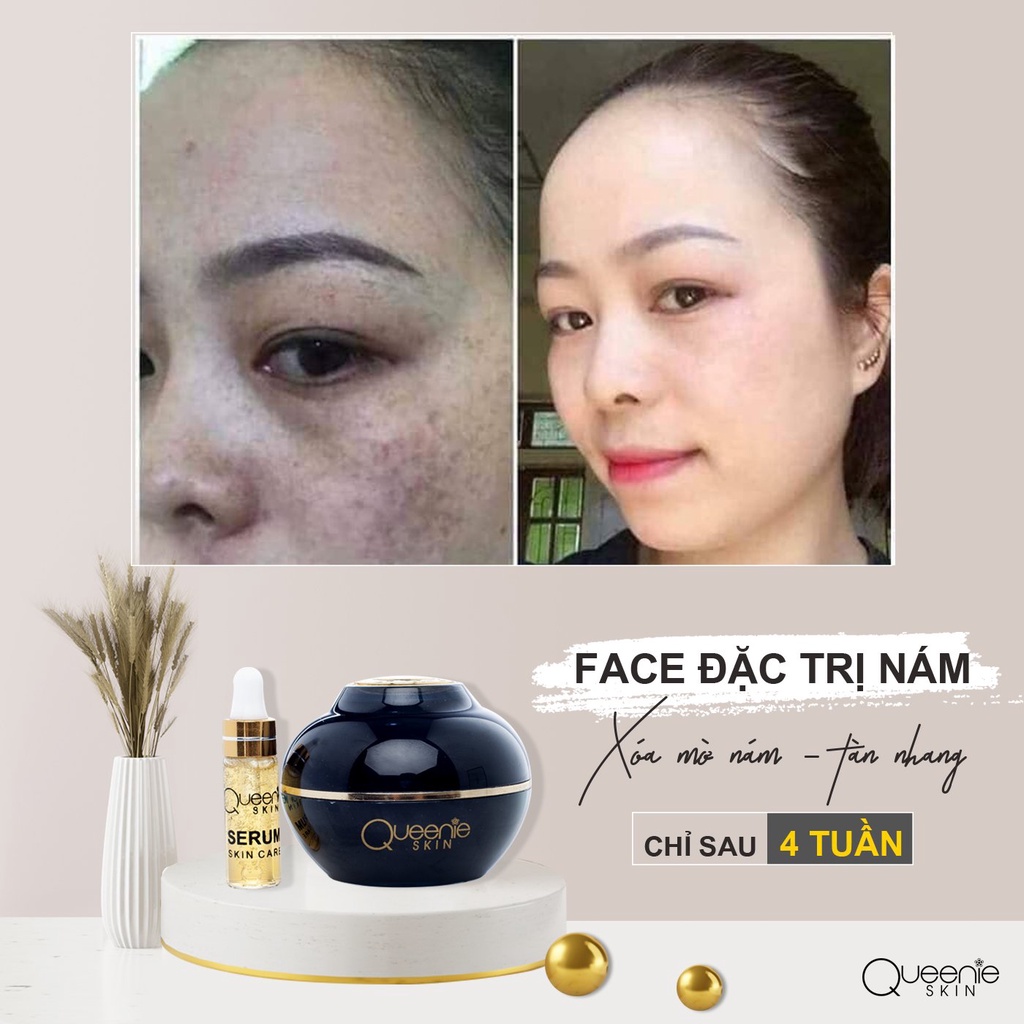 [FreeShip + Tặng Viên Uống &amp; Huyết Thanh Trắng Da] Kem Nám Queenie Skin Chính Hãng - Kem Ngừa Nám Queenie Skin Date 2024