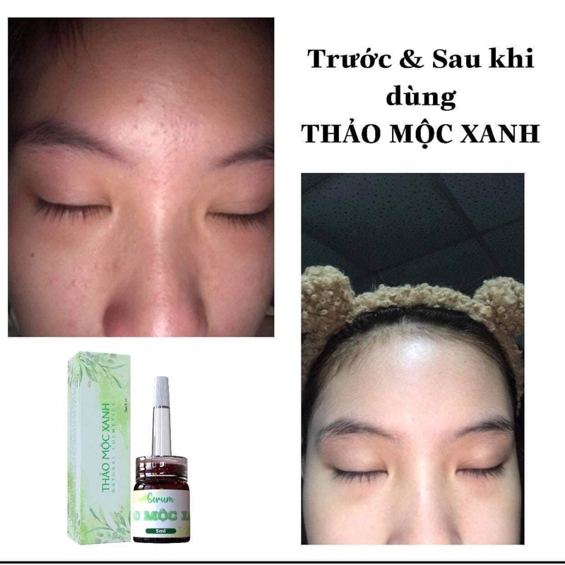 [Freeship] Serum thảo mộc xanh - chính hãng