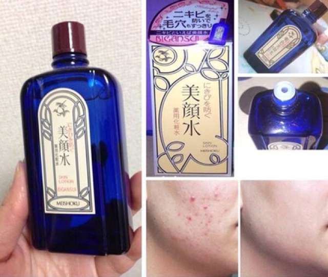 LOTION GIẢM MỤN MEISHOKU BIGANSUI NHẬT BẢN 80ML