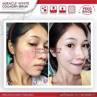 Serum trắng da Miracle
