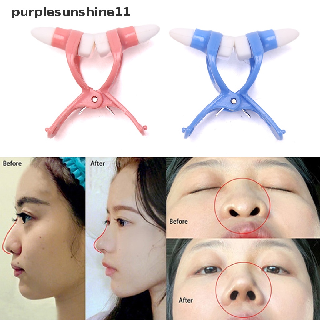 Kẹp Định Hình Nâng Mũi Làm Đẹp Tiện Dụng