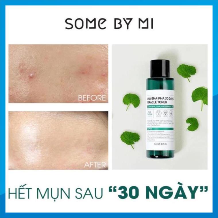 Nước hoa hồng Some By Mi AHA-BHA-PHA 30 Days Miracle Toner 150ml dành da mụn_CoCoDDe.Perfumer29