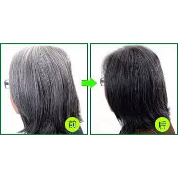 Dầu gội Meidu hỗ trợ nhuộm tóc màu đen tự nhiên | BigBuy360 - bigbuy360.vn