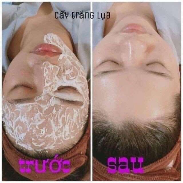 Cấy Lụa - Bộ Cấy Trắng Lụa Hoàng Gia Cho Spa