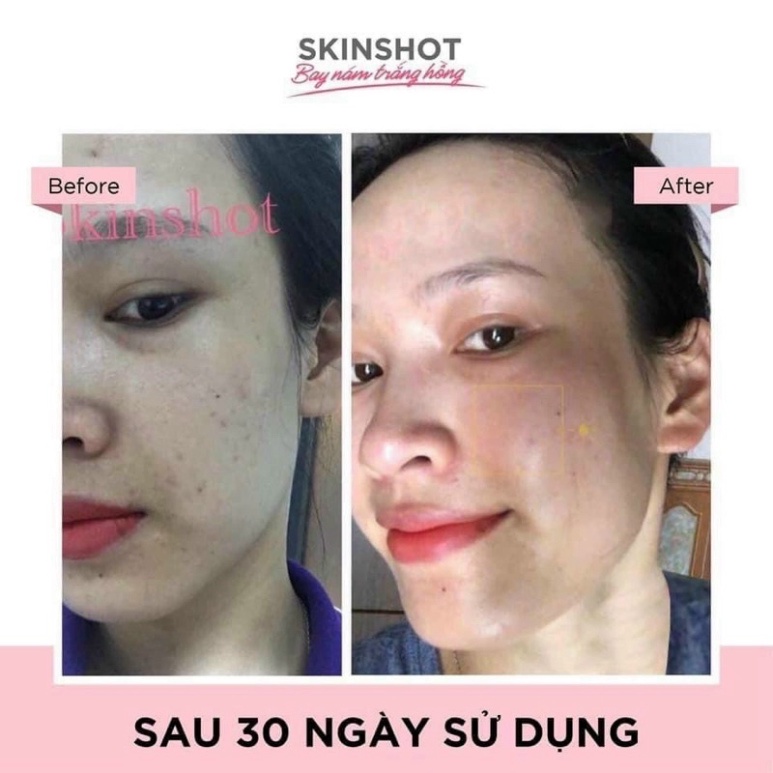 Nước Uống Đẹp Da Chống Lão Hóa Skin Shot Bioactive Collagen Shot  Giúp Duy Trì Cải Thiện Độ Đàn Hồi Cho Da