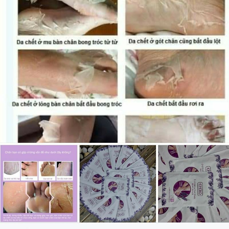 Ủ lột chân hương oải hương mới | BigBuy360 - bigbuy360.vn