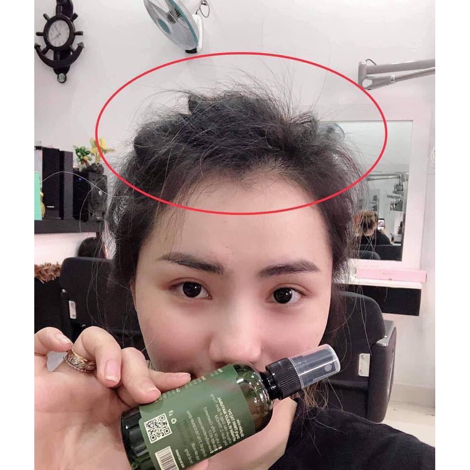 Combo 3 tinh dầu bưởi Vi Jully - Hair Lotion - Mọc Tóc, Tóc Óng Ả, Suôn Mượt