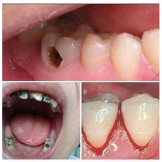 Tinh dầu Răng Miệng Họng Tâm An